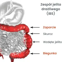 ZJD: Czy to zespół jelita drażliwego? Objawy, diagnostyka, leczenie