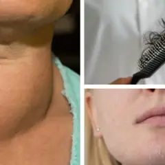 Niedobór jodu: Nie zgaduj! Jak go sprawdzić naprawdę?
