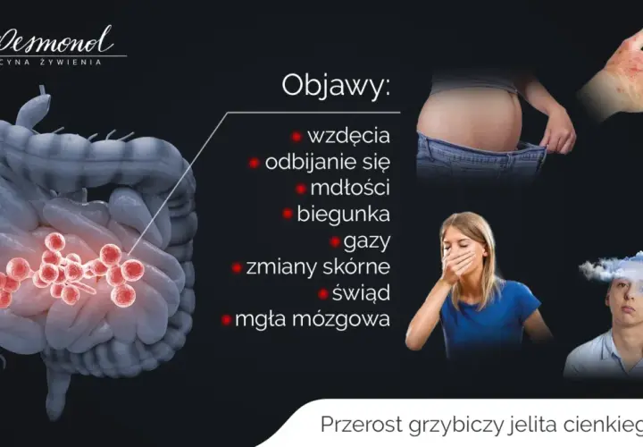 Jelito cienkie: Objawy, choroby, diagnostyka. Kiedy do lekarza?