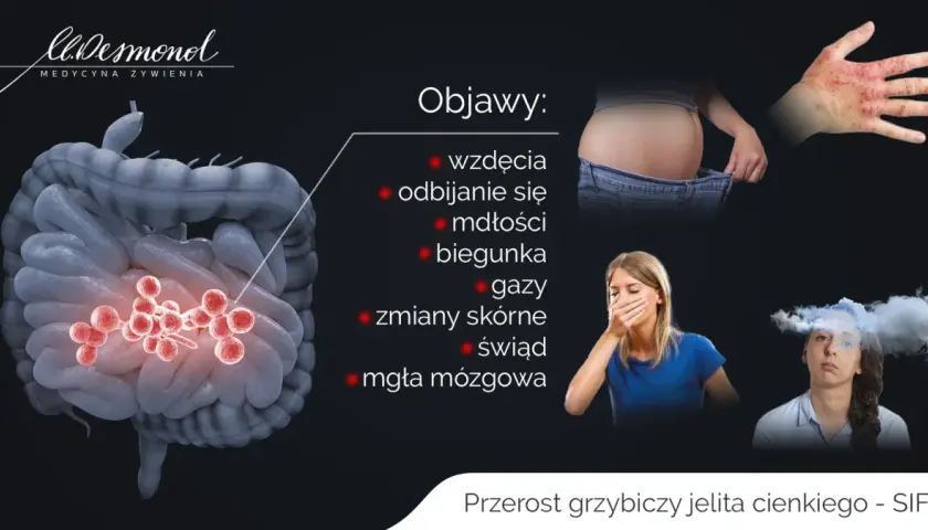 Jelito cienkie: Objawy, choroby, diagnostyka. Kiedy do lekarza?
