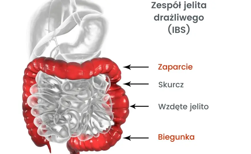 ZJD: Czy to zespół jelita drażliwego? Objawy, diagnostyka, leczenie