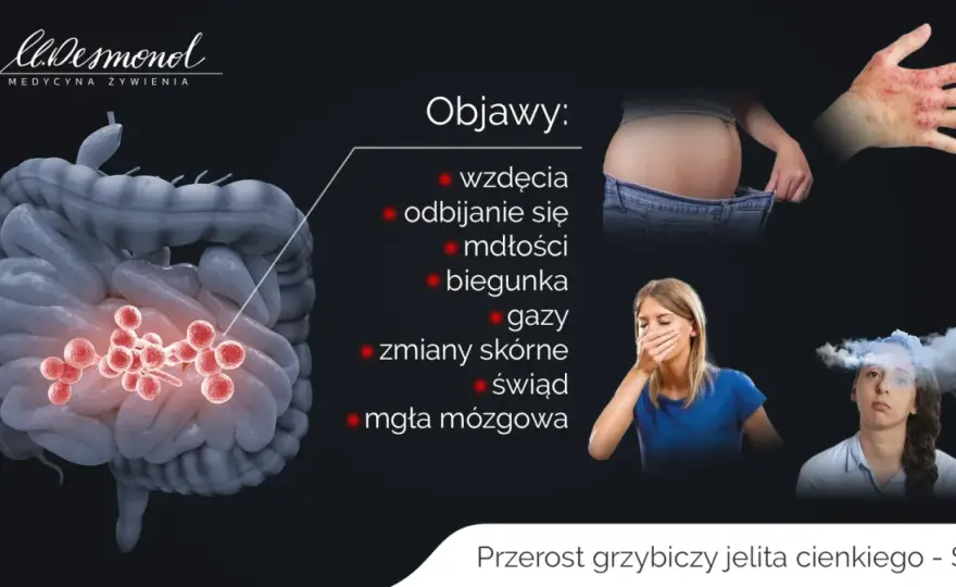 Jelito cienkie: Objawy, choroby, diagnostyka. Kiedy do lekarza?