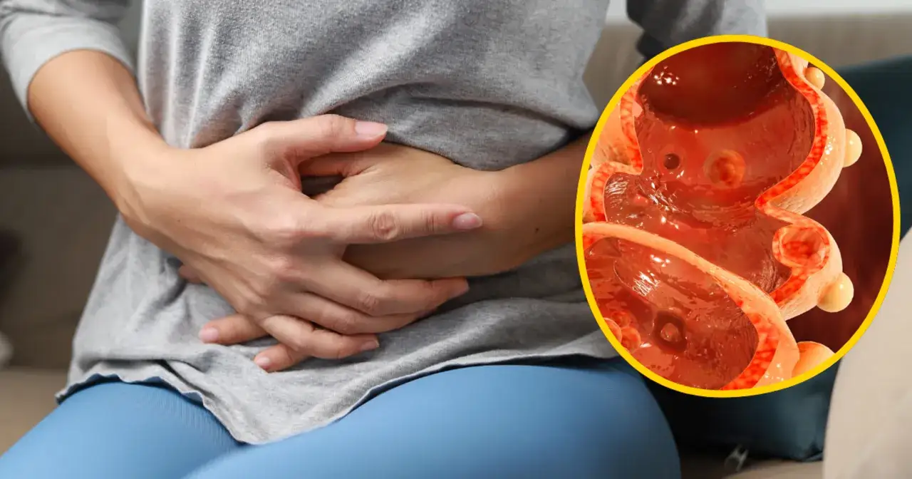 Ból brzucha rak jelita grubego świadomość