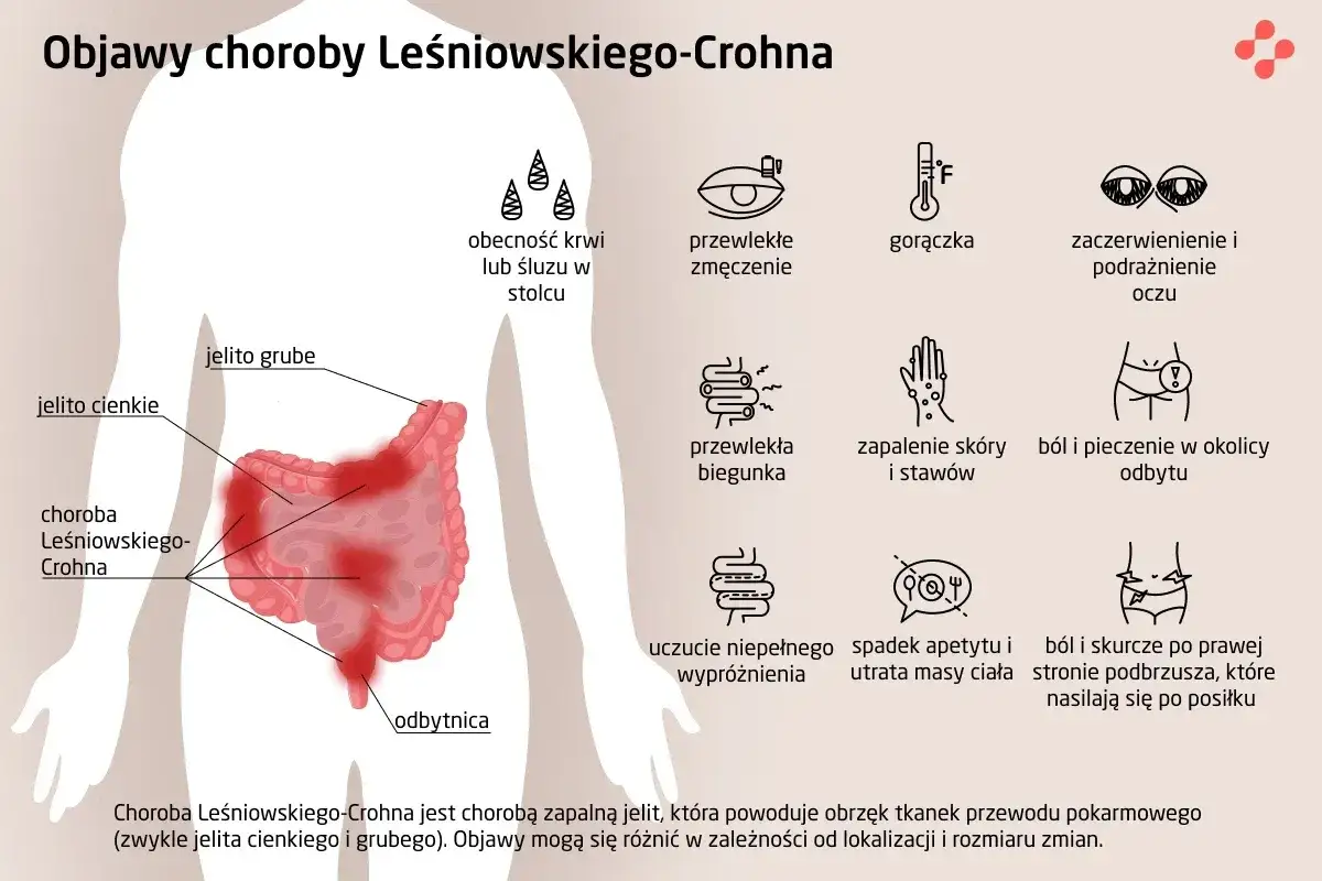 choroby jelita cienkiego objawy
